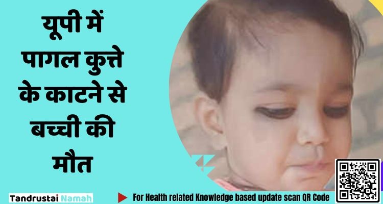 यूपी में पागल कुत्ते के काटने से बच्ची की मौत