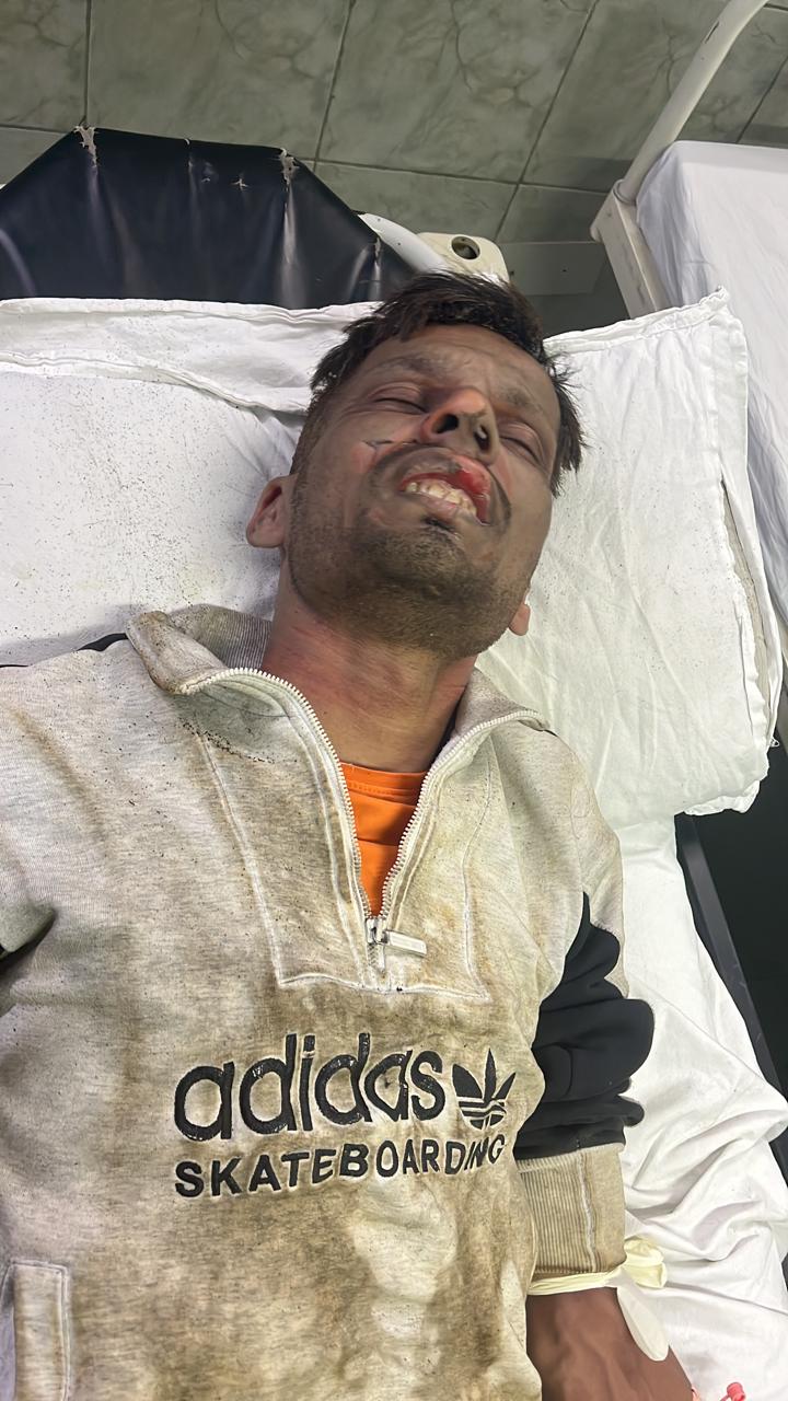 सिगरेट लेने आए हमलावरों ने युवक को खोके के अंदर लगाई आग, 