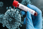 HIV से हो सकती है 30 लाख लोगों की मौ'तें, 